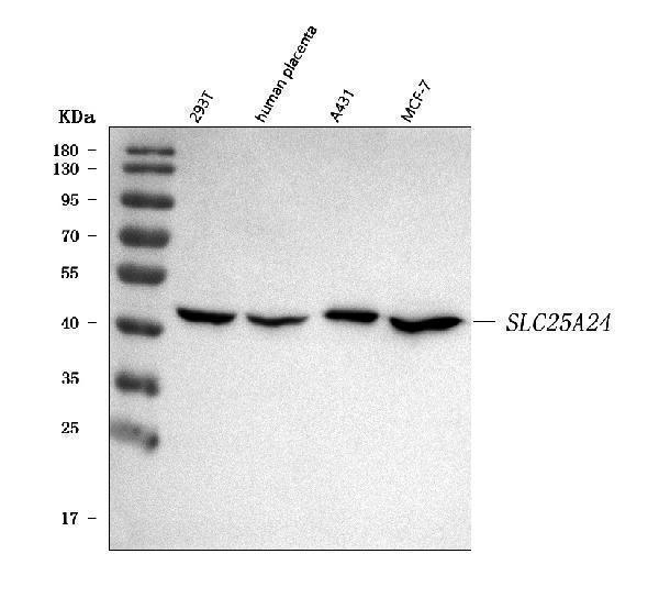  Western blot analysis of SLC25A24 using anti-SLC25A24 antibody (A08355-1)