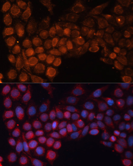 a08355 slc25a24 primary antiboties if testing 3