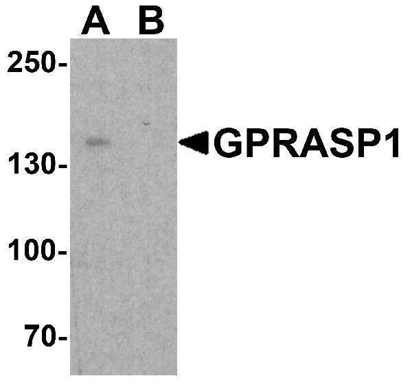 Western blot analysis of GPRASP1 in A-20 cell lysate with GPRASP1 antibody at 1 μg/ml in (A) the absence and (B) the presence of blocking peptide