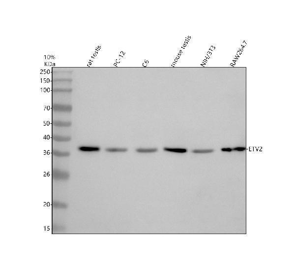  Western blot analysis of ETV2 using anti-ETV2 antibody (A08360-2)