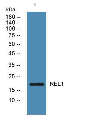Western blot analysis of lysates from DU145 cells, primary antibody was diluted at 1:1000, 4°over night