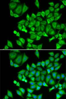 a08370 dhrs9 primary antiboties if testing 3