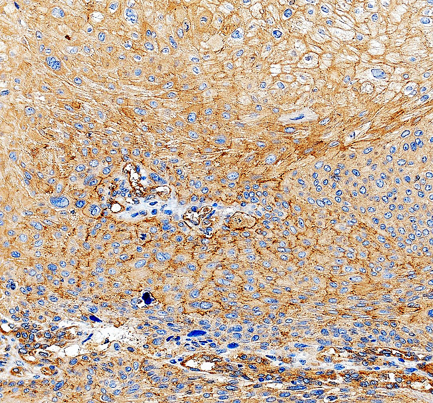 IHC analysis of DUSP26 using anti-DUSP26 antibody (A08372-2)