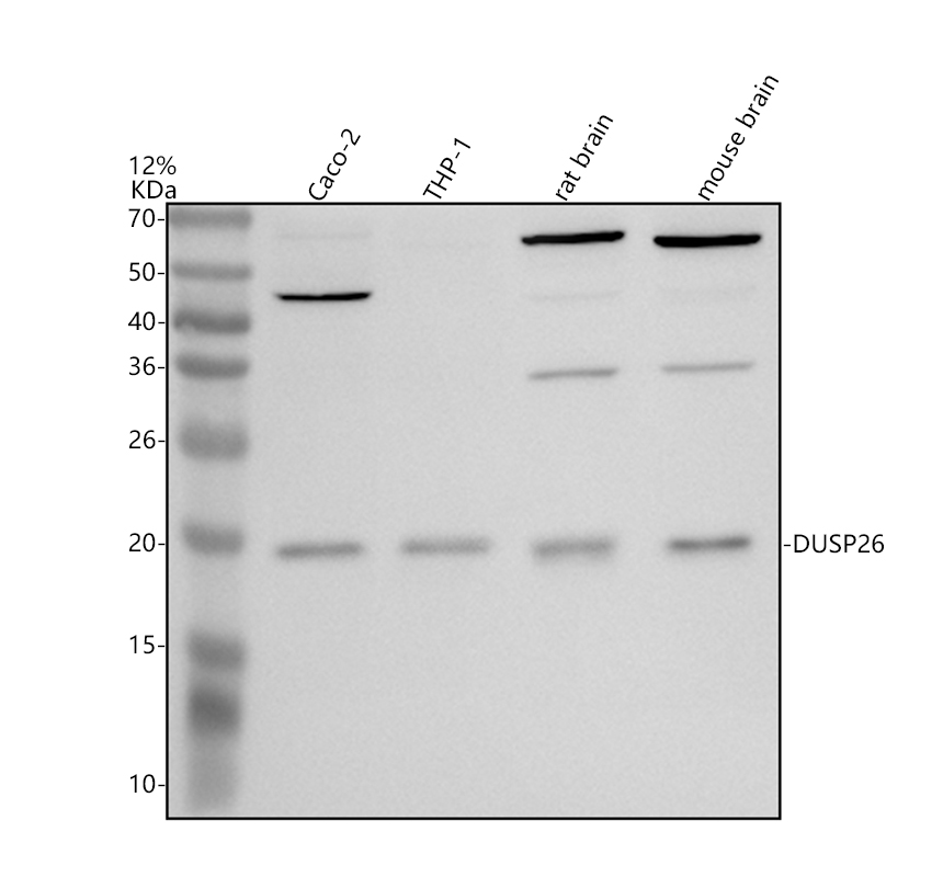 Western blot analysis of DUSP26 using anti-DUSP26 antibody (A08372-2)