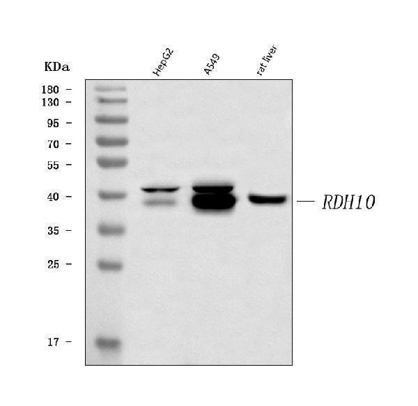  Western blot analysis of RDH10 using anti-RDH10 antibody (A08376-1)
