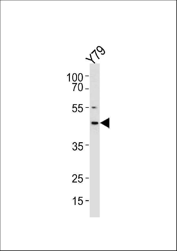 RDH10 Antibody (Center) western blot analysis in Y79 cell line lysates (35ug/lane)