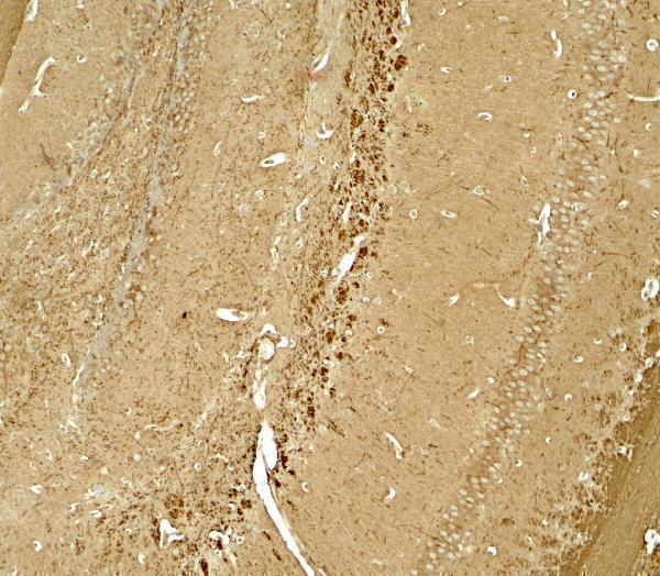 a08377 ninj1 primary antibodies ihc testing 1