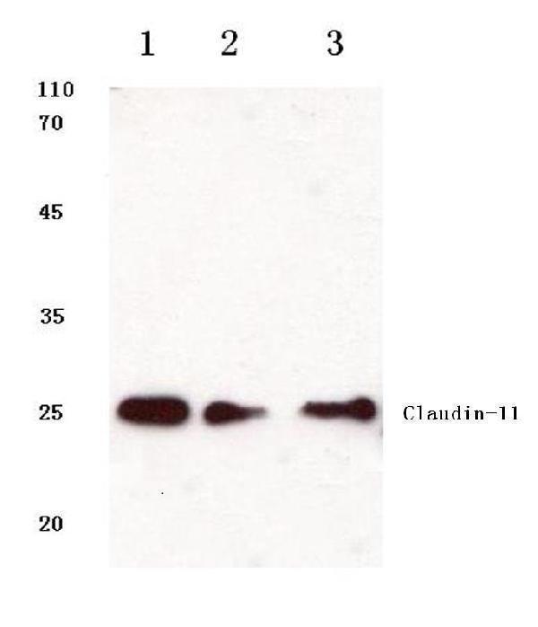 Western blot (WB) analysis of Claudin-11 (S198) polyclonal antibody at 1:500 dilution
Lane1:Hela cell lysate
Lane2:Raw264