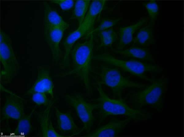 Immunofluorescence microscopy of Rabbit Anti-alpha-Tubulin antibody using HeLa cells fixed with PFA
