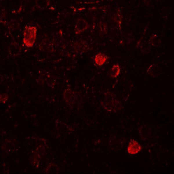 a08385 nelf primary antibodies if testing 3