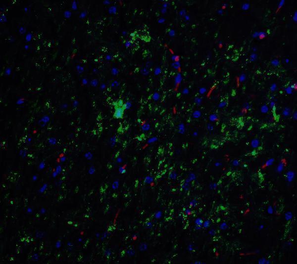 a08385 nelf primary antibodies if testing 5