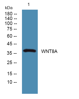 Western blot analysis of lysates from K562 cells, primary antibody was diluted at 1:1000, 4°over night