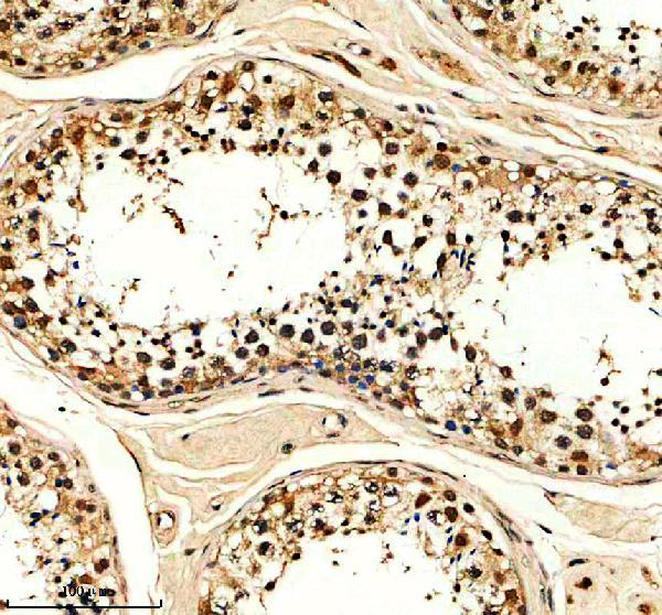a08393 1 hycc1 primary antibodies ihc testing 1