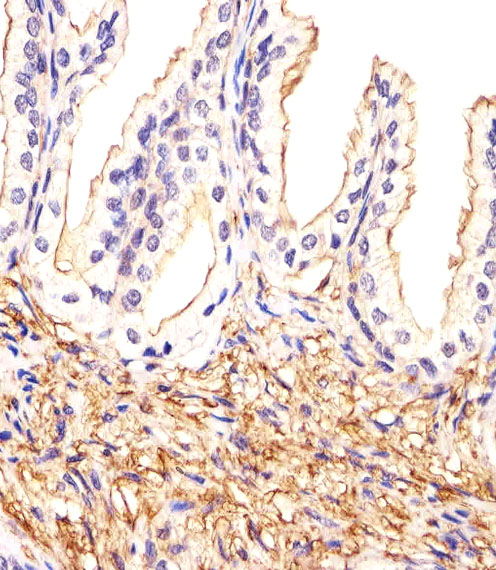 Immunohistochemical analysis of paraffin-embedded H. prostate section using CREBL1 Antibody (C-term) (Cat#A08395-1). A08395-1 was diluted at 1:25 dilution. A undiluted biotinylated goat polyvalent antibody was used as the secondary, followed by DAB staining.