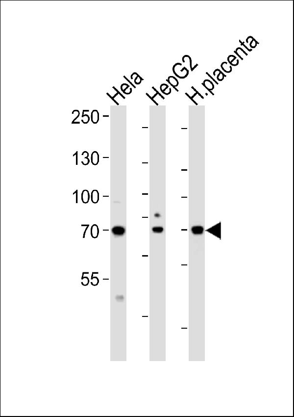 Western blot analysis of lysates from Hela, HepG2 cell line and human placenta tissue lysate (from left to right), using CREBL1Antibody (C-term). A08395-1 was diluted at 1:1000 at each lane. A goat anti-rabbit IgG H&L (HRP) at 1:5000 dilution was used as the secondary antibody. Lysates at 35ug per lane.