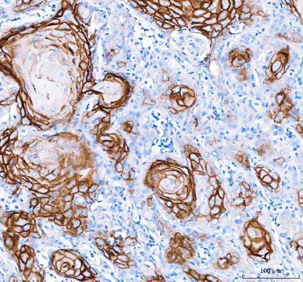  IHC analysis of LYPD3 using anti-LYPD3 antibody (A08396)
