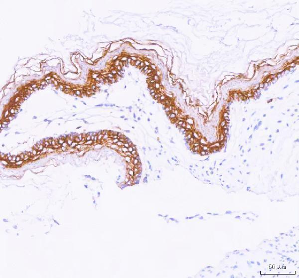  IHC analysis of LYPD3 using anti-LYPD3 antibody (A08396)