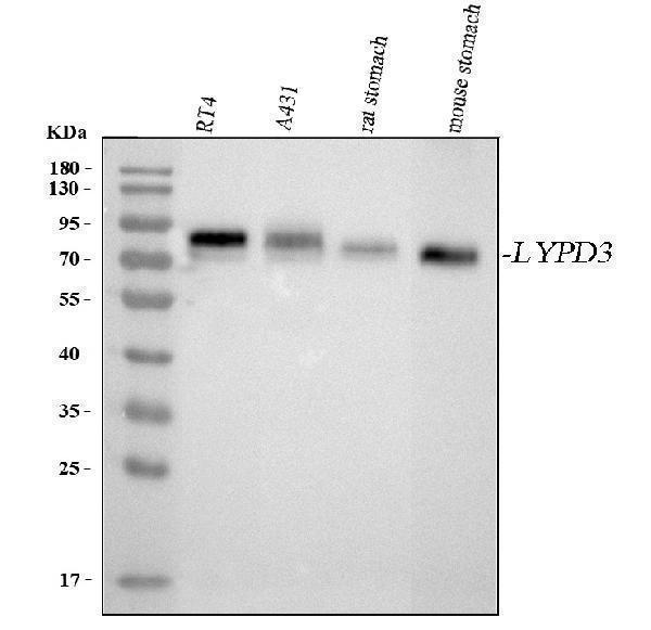  Western blot analysis of LYPD3 using anti-LYPD3 antibody (A08396)