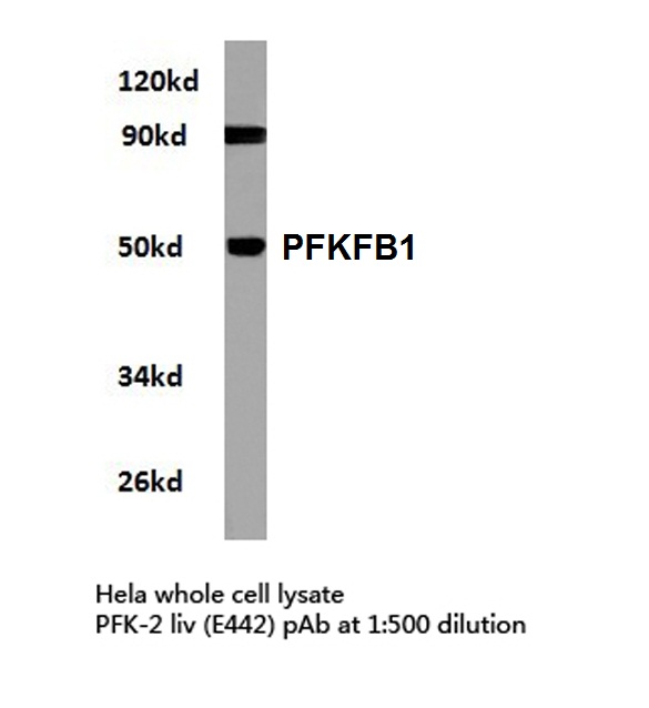 Western blot (WB) analysis of PFKFB1 (E442) polyclonal antibody in extracts from hela cells