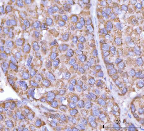  IHC analysis of PFKFB1 using anti-PFKFB1 antibody (A08398-2)