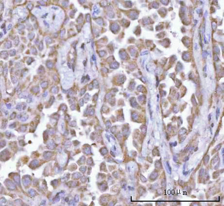  IHC analysis of PFKFB1 using anti-PFKFB1 antibody (A08398-2)