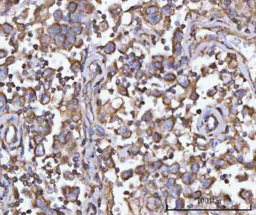 a08398 2 pfkfb1 primary antibodies ihc testing 4