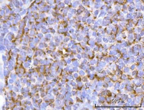 a08398 2 pfkfb1 primary antibodies ihc testing 5
