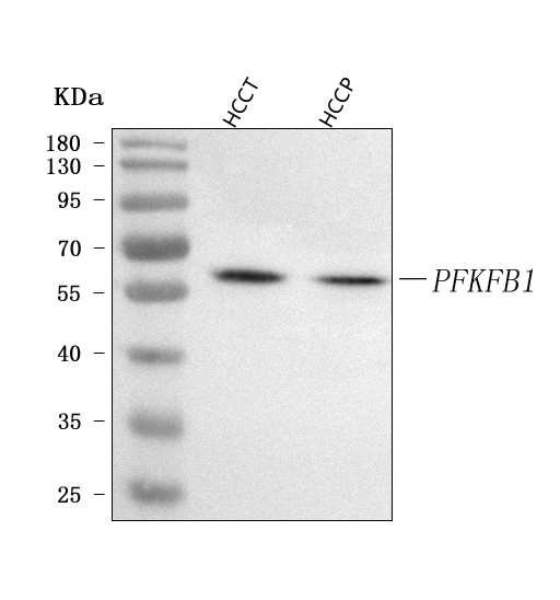  Western blot analysis of PFKFB1 using anti-PFKFB1 antibody (A08398-2)