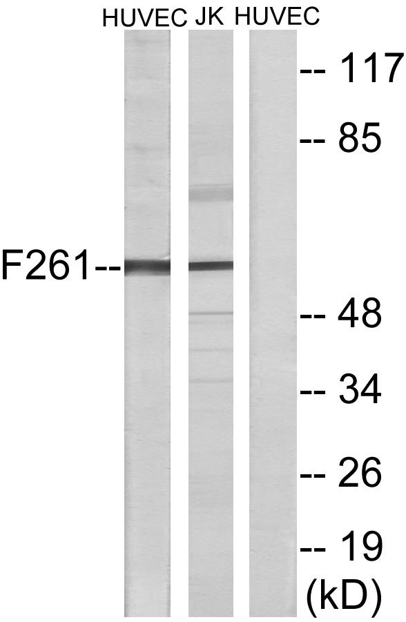 Western blot analysis of lysates from HUVEC cells and Jurkat cells, using PFKFB1 Antibody