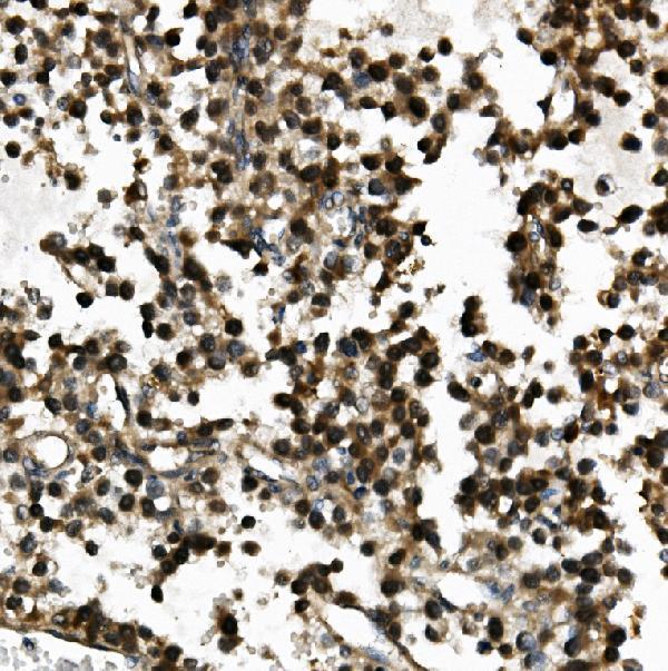  IHC analysis of USP44 using anti-USP44 antibody (A08401-2)