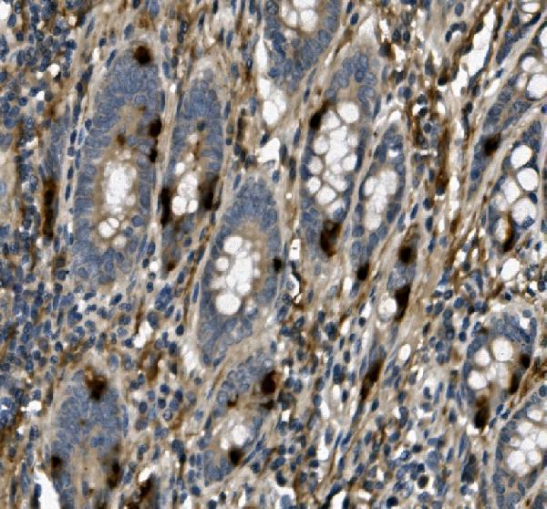  IHC analysis of USP44 using anti-USP44 antibody (A08401-2)