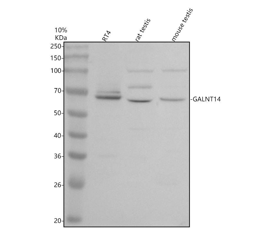 Western blot analysis of GALNT14 using anti-GALNT14 antibody (A08404-1)
