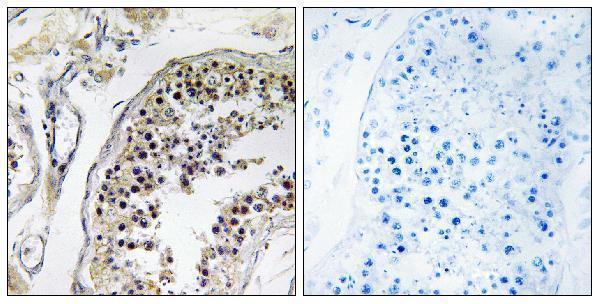 Immunohistochemistry analysis of paraffin-embedded human testis tissue, using CNOT4 Antibody