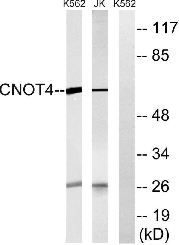 Western blot analysis of lysates from Jurkat and K562 cells, using CNOT4 Antibody