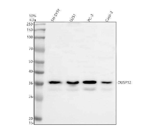 a08406 1 dusp12 primary antibodies wb testing 1