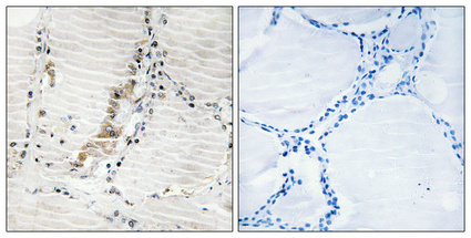 a08407 atp5c1 primary antibodies ihc testing 1