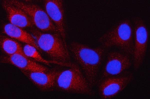  IF analysis of OSBPL8 using anti-OSBPL8 antibody (A08408-2)