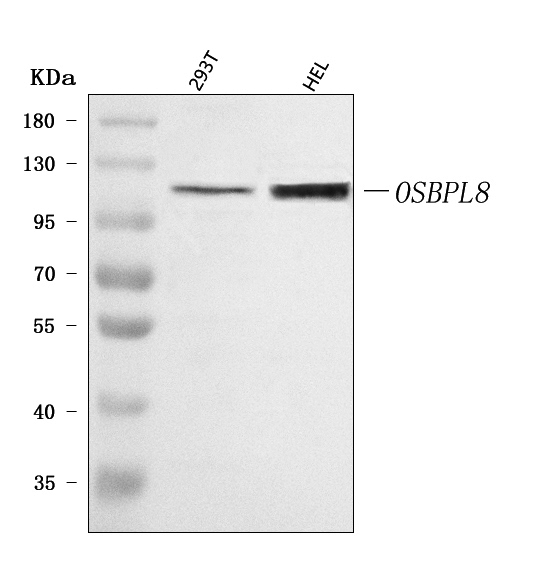  Western blot analysis of OSBPL8 using anti-OSBPL8 antibody (A08408-2)