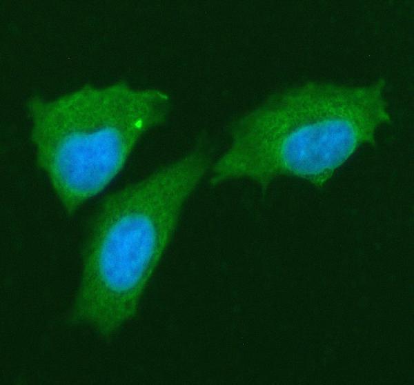 a08410 3 steap2 primary antibodies if testing 1