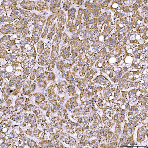  IHC analysis of STAP2 using anti-STAP2 antibody (A08413-3)