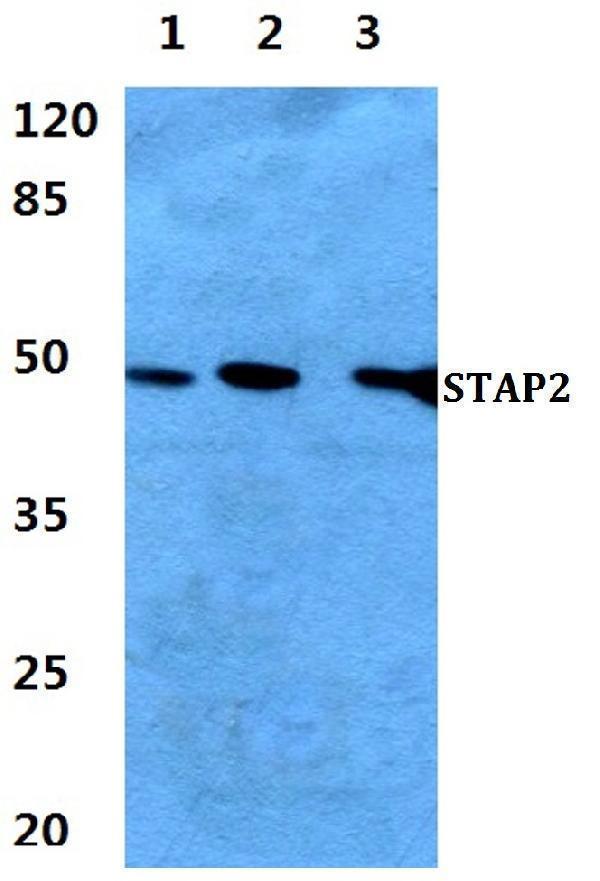 a08413 stap2 primary antiboties wb testing 1