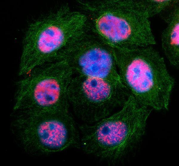 a08415 1 ifi35 primary antibodies if testing 1