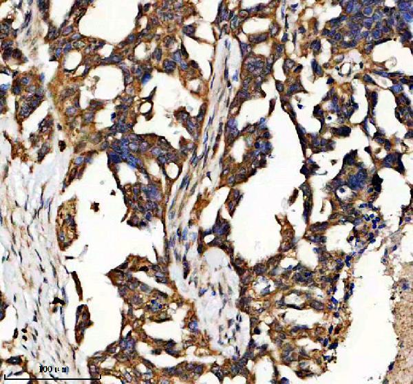 a08415 1 ifi35 primary antibodies ihc testing 1