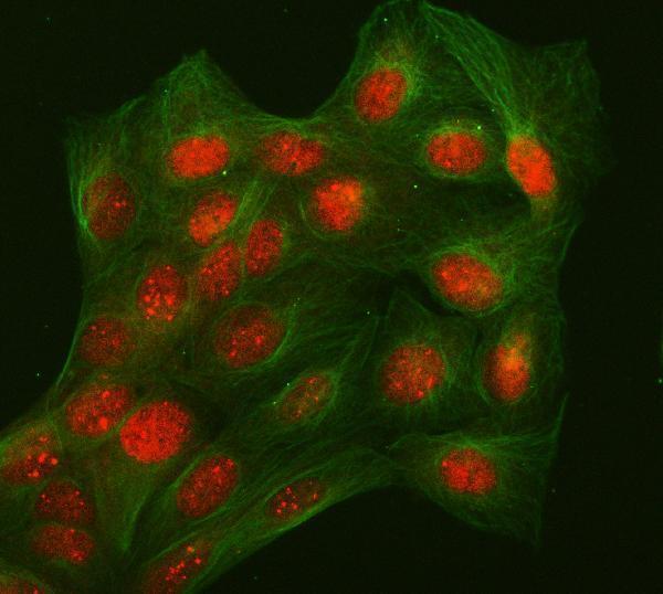 a08416 1 l3mbtl2 primary antibodies if testing 5