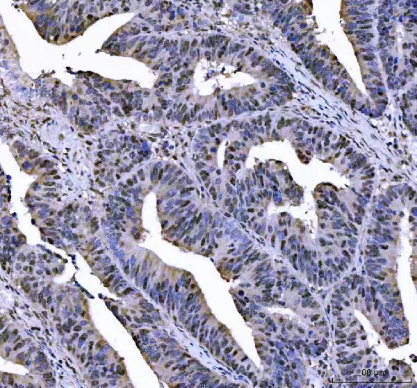  IHC analysis of L3MBTL2 using anti-L3MBTL2 antibody (A08416-1)