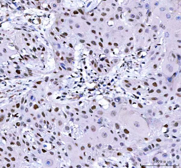  IHC analysis of L3MBTL2 using anti-L3MBTL2 antibody (A08416-1)
