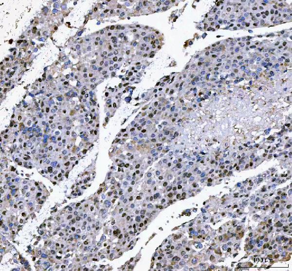 a08416 1 l3mbtl2 primary antibodies ihc testing 4