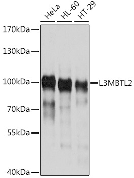 a08416 l3mbtl2 primary antiboties wb testing 1