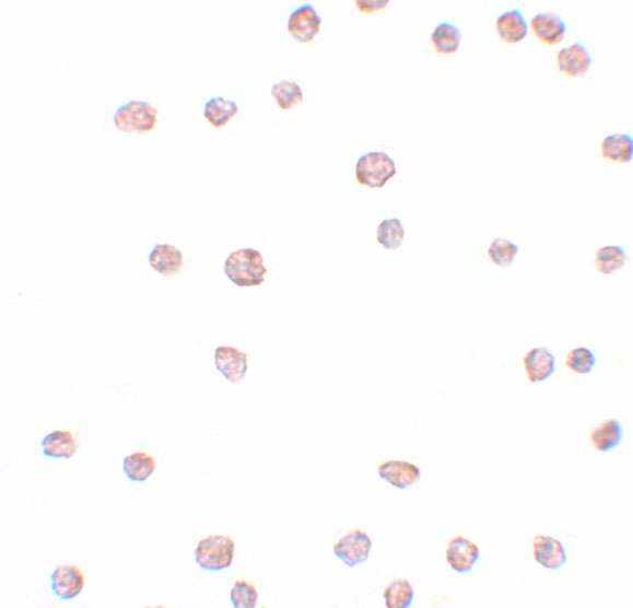 Immunocytochemistry of ARHGAP18 in 3T3 cells with ARHGAP18 antibody at 2