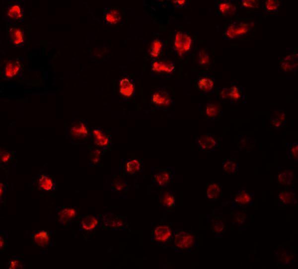 Immunofluorescence of ARHGAP18 in 3T3 cells with ARHGAP18 antibody at 20 μg/mL